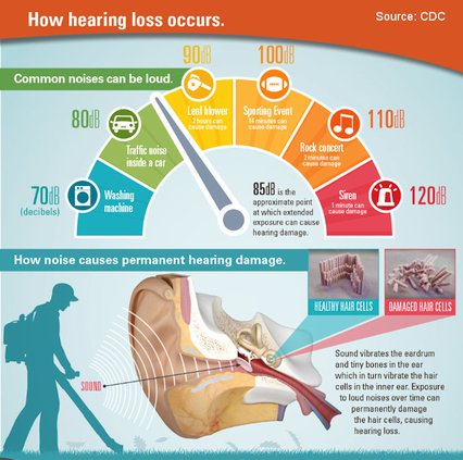 extension hearing chart